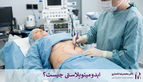 ابدومینوپلاستی