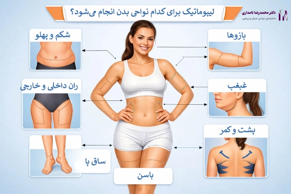 لیپوماتیک برای کدام نواحی بدن انجام میشود؟